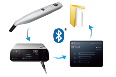 Connexion sans fil avec le Surgic Pro2