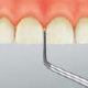 Restorative(For Preparation of crown cores)/S71D -AIR SCALER